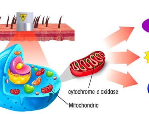 Understanding The Dynamics of Class IV Laser Therapy