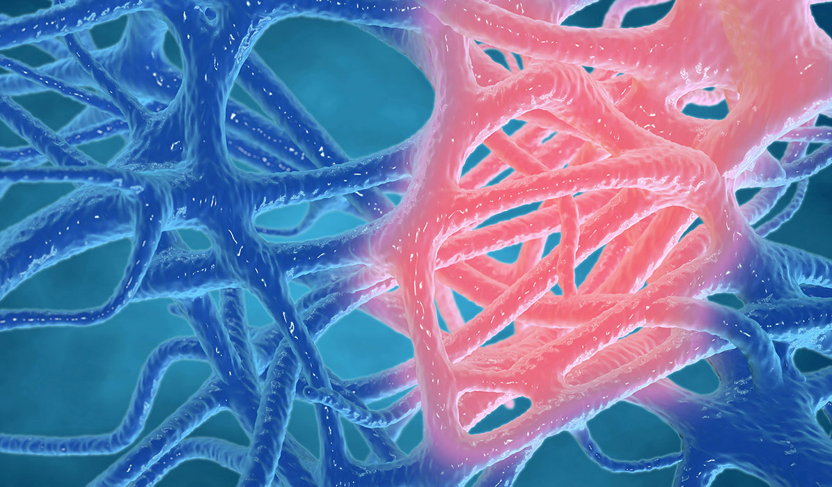 Understanding the dynamics of Class IV Laser Therapy