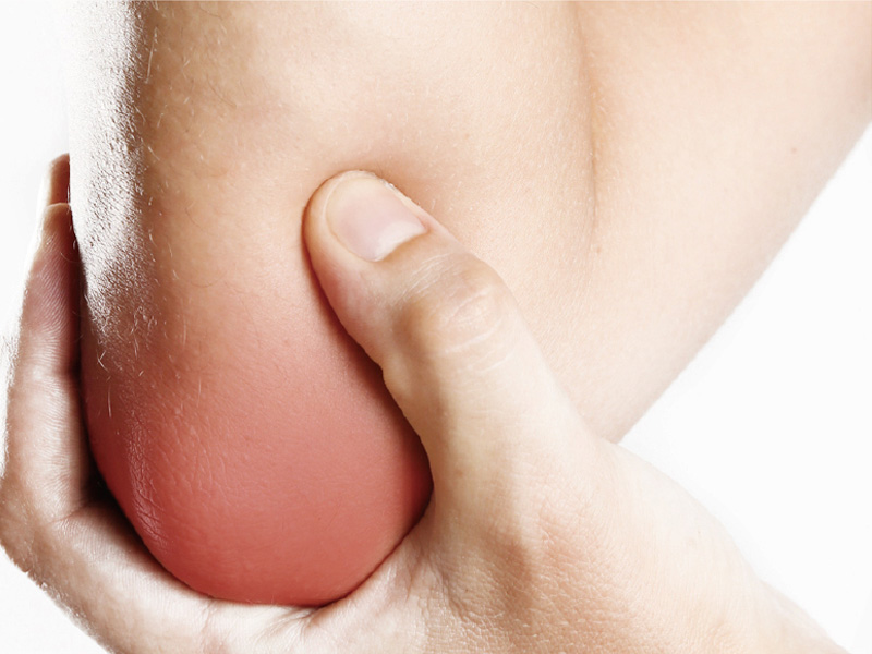Hands-free Class IV laser and shockwave treatment for elbow pain.