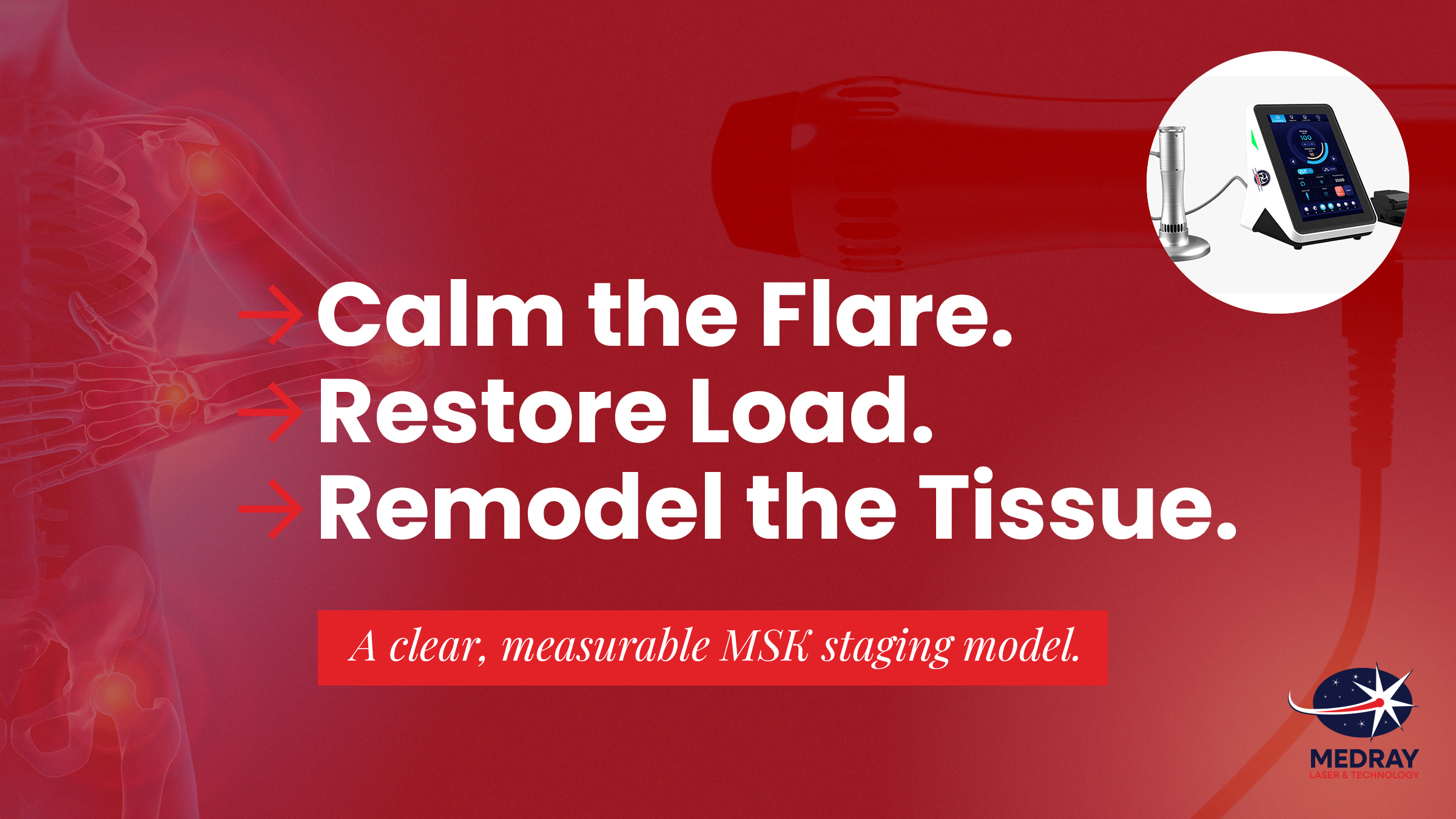 Clinical staging at the pathology site using photobiomodulation and targeted shockwave for musculoskeletal (MSK) care